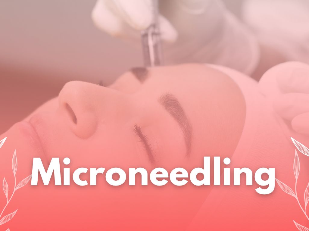 microneedling 